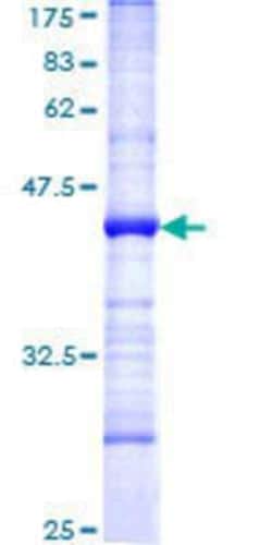 Novus Biologicals Recombinant Human HECTD2 GST (N-Term) Protein 25 &mu;g | Buy Online | Novus Biologicals&trade; | Fisher Scientific