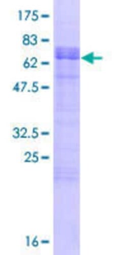 Novus Biologicals Recombinant Human LDLRAD3 GST (N-Term) Protein 10 &mu;g | Buy Online | Novus Biologicals&trade; | Fisher Scientific