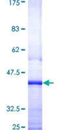 Novus Biologicals Recombinant Human SESN3 GST (N-Term) Protein 10 &mu;g | Buy Online | Novus Biologicals&trade; | Fisher Scientific