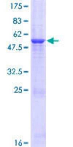 Novus Biologicals Recombinant Human GLT1D1 GST (N-Term) Protein 25 &mu;g | Buy Online | Novus Biologicals&trade; | Fisher Scientific