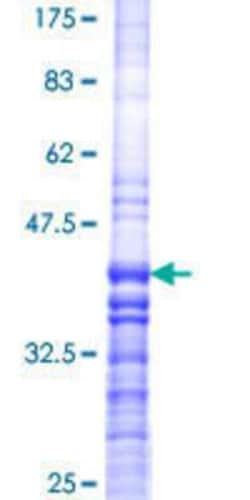 Novus Biologicals Recombinant Human Bestrophin 3 GST (N-Term) Protein 10 &mu;g | Buy Online | Novus Biologicals&trade; | Fisher Scientific