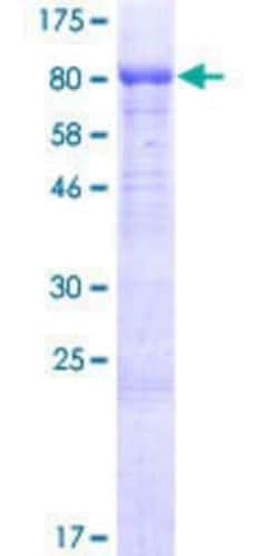 Novus Biologicals Recombinant Human ISM2 GST (N-Term) Protein 25 &mu;g | Buy Online | Novus Biologicals&trade; | Fisher Scientific