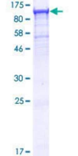 Novus Biologicals Recombinant Human TTC7B GST (N-Term) Protein 25 &mu;g | Buy Online | Novus Biologicals&trade; | Fisher Scientific