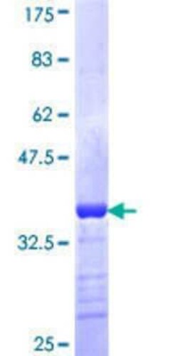 Novus Biologicals Recombinant Human ZNF690 GST (N-Term) Protein 25 &mu;g | Buy Online | Novus Biologicals&trade; | Fisher Scientific