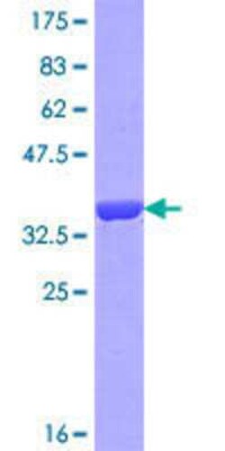 Novus Biologicals Recombinant Human OTOA GST (N-Term) Protein 10 &mu;g | Buy Online | Novus Biologicals&trade; | Fisher Scientific