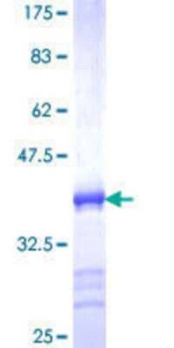 Novus Biologicals Recombinant Human RNF151 GST (N-Term) Protein 25 &mu;g | Buy Online | Novus Biologicals&trade; | Fisher Scientific