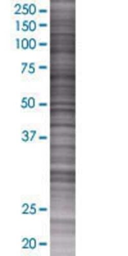 Novus Biologicals&trade;&nbsp;TOM1L2 293T Cell Transient Overexpression Lysate