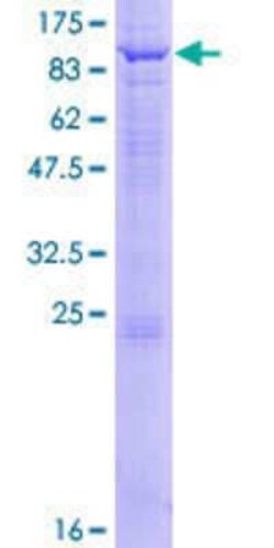Novus Biologicals Recombinant Human WDR16 GST (N-Term) Protein 25 &mu;g | Buy Online | Novus Biologicals&trade; | Fisher Scientific