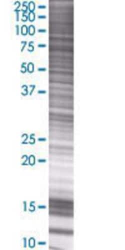 Novus Biologicals&trade;&nbsp;EME1 293T Cell Transient Overexpression Lysate
