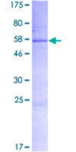 Novus Biologicals Recombinant Human MCART2 GST (N-Term) Protein 2 &mu;g | Buy Online | Novus Biologicals&trade; | Fisher Scientific