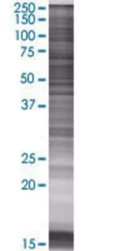 Novus Biologicals&trade;&nbsp;APCDD1 293T Cell Transient Overexpression Lysate