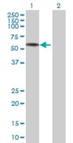 Novus Biologicals APCDD1 293T Cell Transient Overexpression Lysate 0,1 mL | Buy Online | Novus Biologicals&trade; | Fisher Scientific