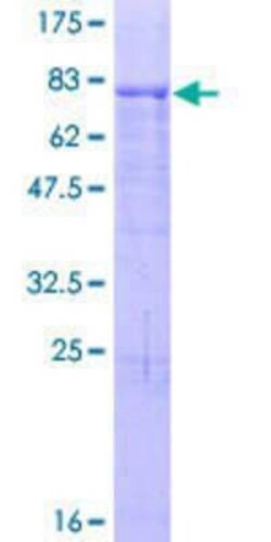 Novus Biologicals Recombinant Human ZNF480 GST (N-Term) Protein 25 &mu;g | Buy Online | Novus Biologicals&trade; | Fisher Scientific