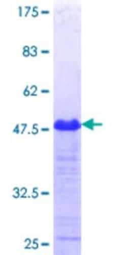 Novus Biologicals Recombinant Human HIPK4 GST (N-Term) Protein 25 &mu;g | Buy Online | Novus Biologicals&trade; | Fisher Scientific