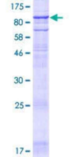 Novus Biologicals Recombinant Human TMC4 GST (N-Term) Protein 10 &mu;g | Buy Online | Novus Biologicals&trade; | Fisher Scientific