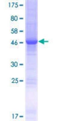Novus Biologicals Recombinant Human SPC24 GST (N-Term) Protein 25 &mu;g | Buy Online | Novus Biologicals&trade; | Fisher Scientific
