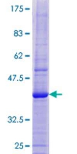 Novus Biologicals Recombinant Human ZNF738 GST (N-Term) Protein 25 &mu;g | Buy Online | Novus Biologicals&trade; | Fisher Scientific