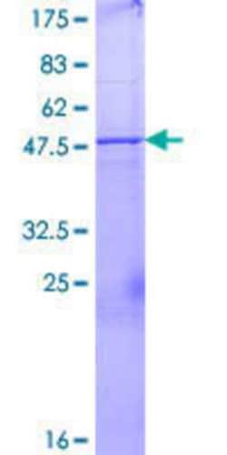 Novus Biologicals Recombinant Human UBE2U GST (N-Term) Protein 2 &mu;g | Buy Online | Novus Biologicals&trade; | Fisher Scientific