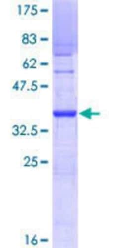 Novus Biologicals Recombinant Human UBE2U GST (N-Term) Protein 10 &mu;g | Buy Online | Novus Biologicals&trade; | Fisher Scientific
