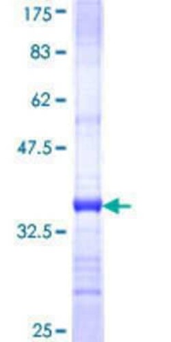 Novus Biologicals Recombinant Human MOBKL2C GST (N-Term) Protein 25 &mu;g | Buy Online | Novus Biologicals&trade; | Fisher Scientific