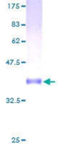Novus Biologicals Recombinant Human CNIH3 GST (N-Term) Protein 10 &mu;g | Buy Online | Novus Biologicals&trade; | Fisher Scientific