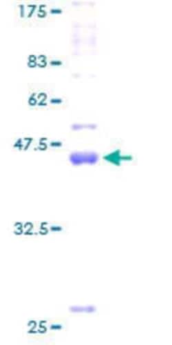 Novus Biologicals Recombinant Human Claudin-19 GST (N-Term) Protein 2 &mu;g | Buy Online | Novus Biologicals&trade; | Fisher Scientific