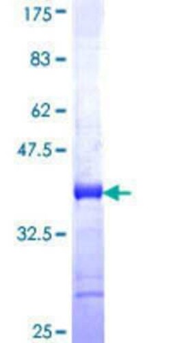 Novus Biologicals Recombinant Human WFDC5 GST (N-Term) Protein 10 &mu;g | Buy Online | Novus Biologicals&trade; | Fisher Scientific