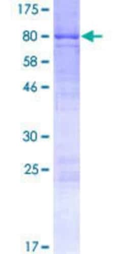 Novus Biologicals Recombinant Human BPIFB4 GST (N-Term) Protein 10 &mu;g | Buy Online | Novus Biologicals&trade; | Fisher Scientific