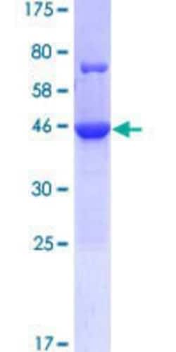 R&D Systems&trade;&nbsp;Recombinant Human CCDC117 GST (N-Term) Protein