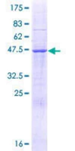 Novus Biologicals Recombinant Human MEI1 GST (N-Term) Protein 25 &mu;g | Buy Online | Novus Biologicals&trade; | Fisher Scientific
