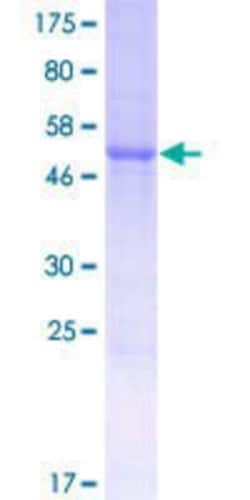 Novus Biologicals Recombinant Human FAM109B GST (N-Term) Protein 10 &mu;g | Buy Online | Novus Biologicals&trade; | Fisher Scientific