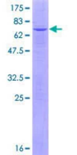 Novus Biologicals&trade;&nbsp;Recombinant Human Phospholipase B1 GST (N-Term) Protein