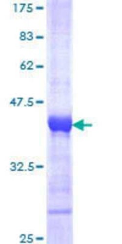 Novus Biologicals&trade;&nbsp;Recombinant Human DTX3L GST (N-Term) Protein