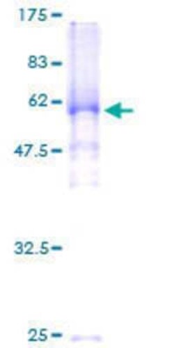 Novus Biologicals Recombinant Human Shugoshin GST (N-Term) Protein 2 &mu;g | Buy Online | Novus Biologicals&trade; | Fisher Scientific