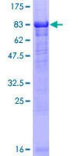 Novus Biologicals Recombinant Human NEK10 GST (N-Term) Protein 25 &mu;g | Buy Online | Novus Biologicals&trade; | Fisher Scientific