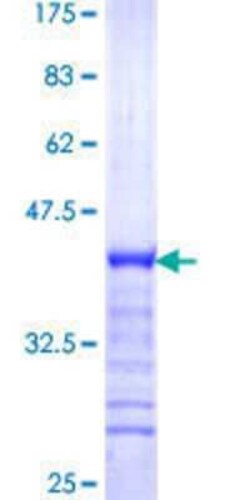 Novus Biologicals Recombinant Human NFXL1 GST (N-Term) Protein 25 &mu;g | Buy Online | Novus Biologicals&trade; | Fisher Scientific