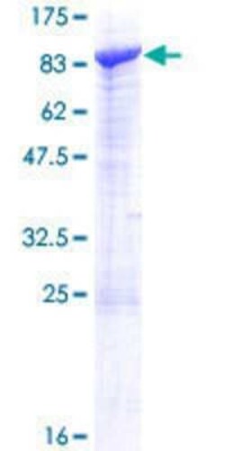 Novus Biologicals Recombinant Human SCFD2 GST (N-Term) Protein 10 &mu;g | Buy Online | Novus Biologicals&trade; | Fisher Scientific
