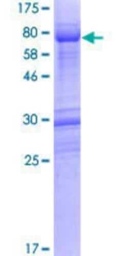 Novus Biologicals Recombinant Human FAM53A GST (N-Term) Protein 25 &mu;g | Buy Online | Novus Biologicals&trade; | Fisher Scientific
