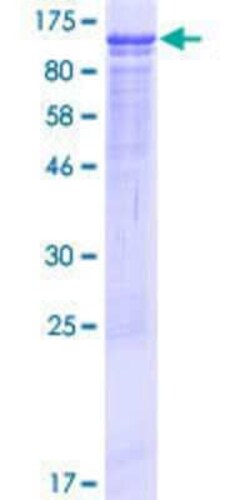 Novus Biologicals Recombinant Human CREB3 regulatory factor GST (N-Term) Protein 10 &mu;g | Buy Online | Novus Biologicals&trade; | Fisher Scientific