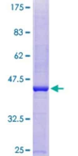 Novus Biologicals Recombinant Human SLC25A48 GST (N-Term) Protein 25 &mu;g | Buy Online | Novus Biologicals&trade; | Fisher Scientific