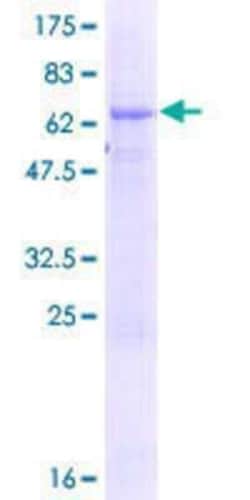 Novus Biologicals&trade;&nbsp;Recombinant Human TTC23L GST (N-Term) Protein