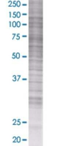 Novus Biologicals PPP1R2P3 293T Cell Transient Overexpression Lysate 0,1 mL | Buy Online | Novus Biologicals&trade; | Fisher Scientific