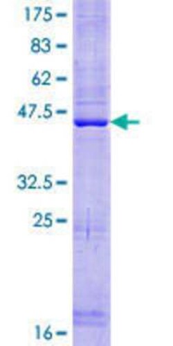 Novus Biologicals Recombinant Human PLAC8L1 GST (N-Term) Protein 10 &mu;g | Buy Online | Novus Biologicals&trade; | Fisher Scientific