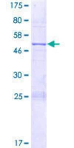 Novus Biologicals Recombinant Human SAMD3 GST (N-Term) Protein 2 &mu;g | Buy Online | Novus Biologicals&trade; | Fisher Scientific