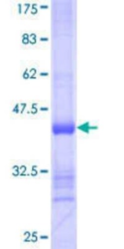 Novus Biologicals Recombinant Human IBRDC1 GST (N-Term) Protein 25 &mu;g | Buy Online | Novus Biologicals&trade; | Fisher Scientific