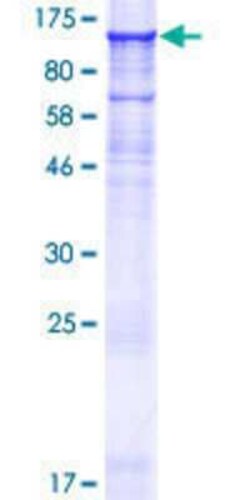 Novus Biologicals Recombinant Human IQUB GST (N-Term) Protein 25 &mu;g | Buy Online | Novus Biologicals&trade; | Fisher Scientific