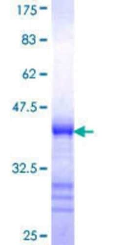 Novus Biologicals Recombinant Human PRAGMIN GST (N-Term) Protein 25 &mu;g | Buy Online | Novus Biologicals&trade; | Fisher Scientific