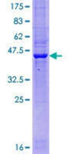 Novus Biologicals Recombinant Human TMEM65 GST (N-Term) Protein 10 &mu;g | Buy Online | Novus Biologicals&trade; | Fisher Scientific