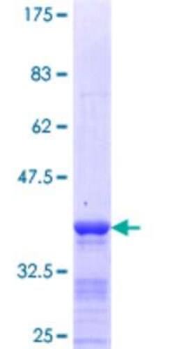 Novus Biologicals Recombinant Human RDH10 GST (N-Term) Protein 25 &mu;g | Buy Online | Novus Biologicals&trade; | Fisher Scientific