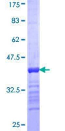 Novus Biologicals Recombinant Human Adenylate Kinase 8 GST (N-Term) Protein 10 &mu;g | Buy Online | Novus Biologicals&trade; | Fisher Scientific